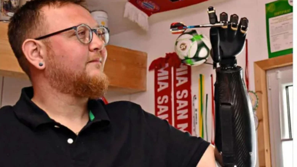 Mann mit Handprothese