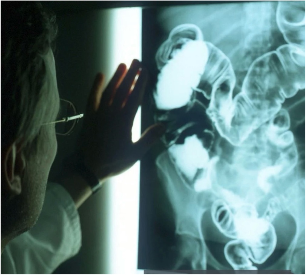 Arzt vor Röntgenbild